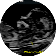 Ultrasonido genético 11-14